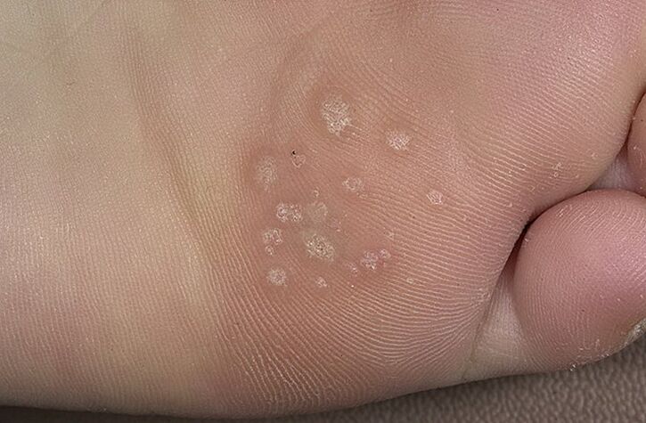 Wart sociale