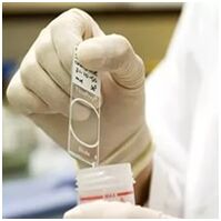 Diagnosi di infezione da papillomavirus