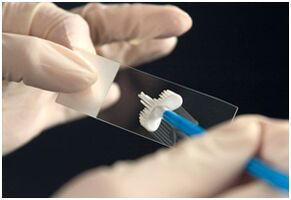 PAPA Test per l'infezione da papillomavirus