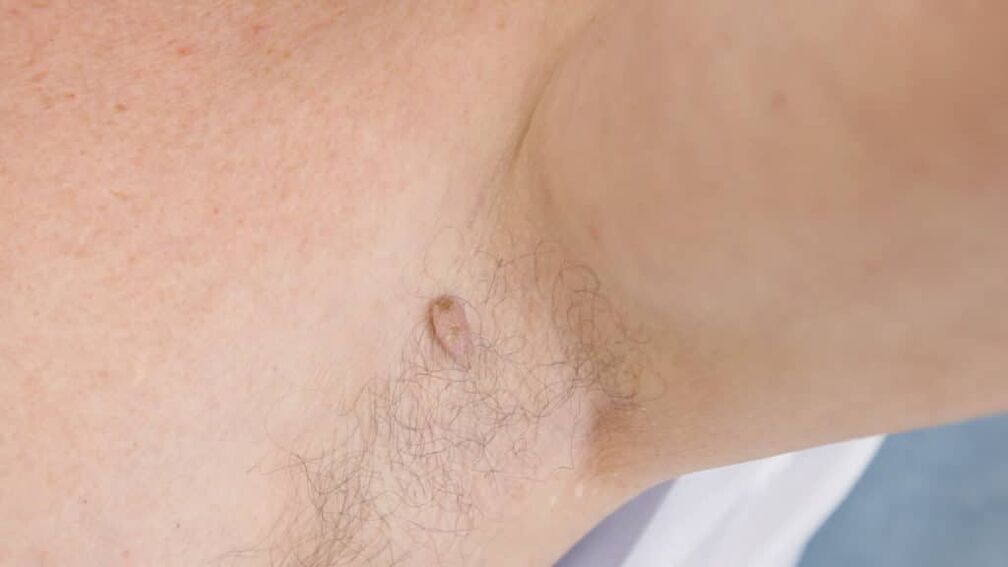 Papilloma cinematografico