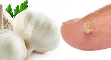 trattamento delle verruche con rimedi popolari