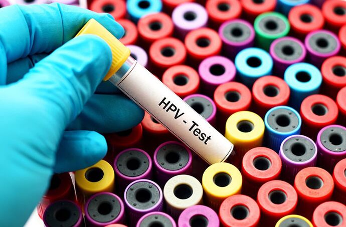 Analisi del sangue del papillomavirus umano
