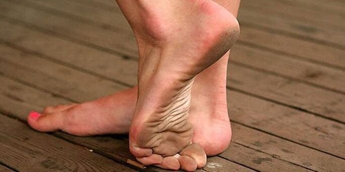 Piedi sporchi come causa di verruche plantari